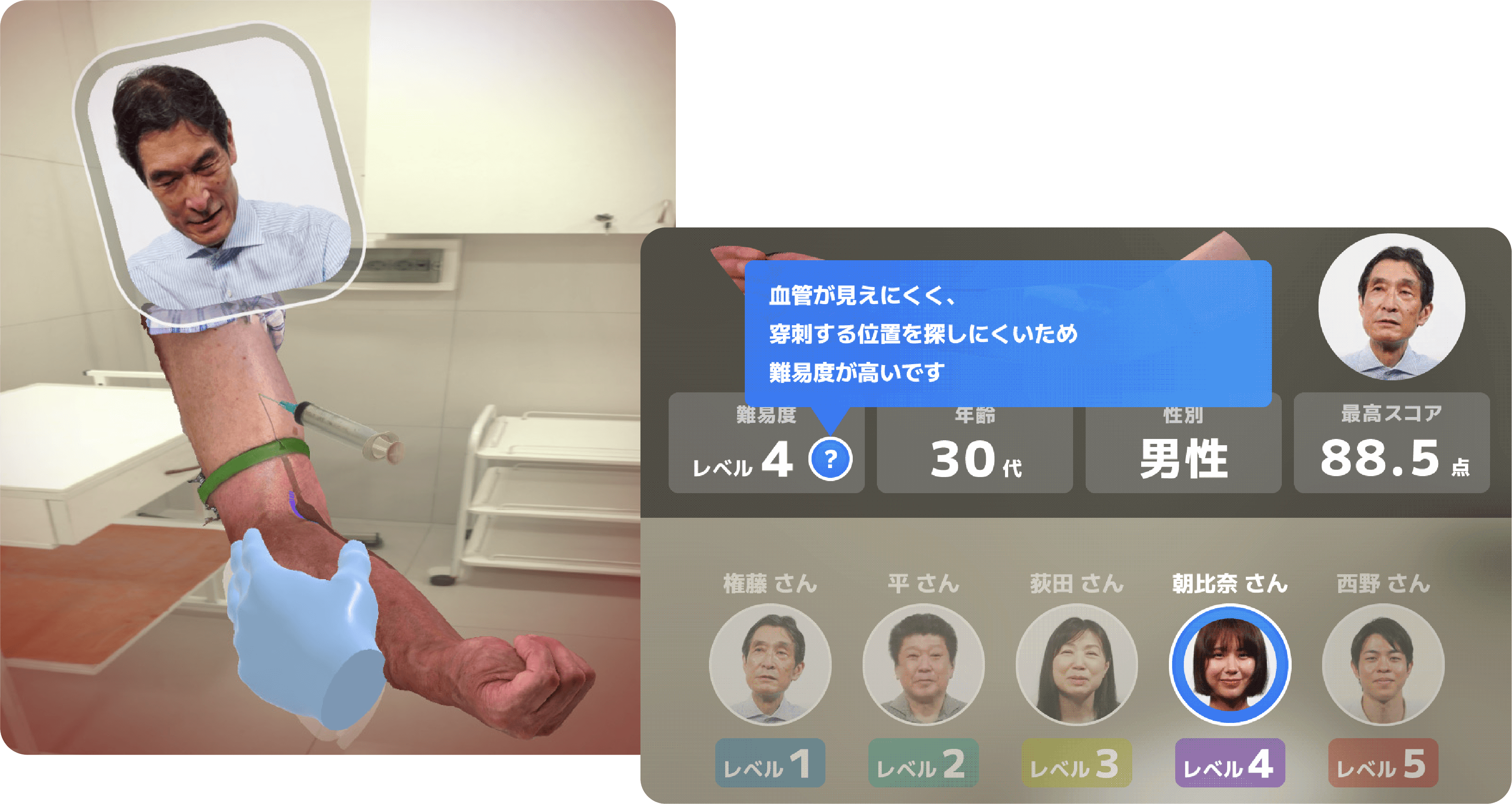 3Dスキャンしたリアルな人間の腕